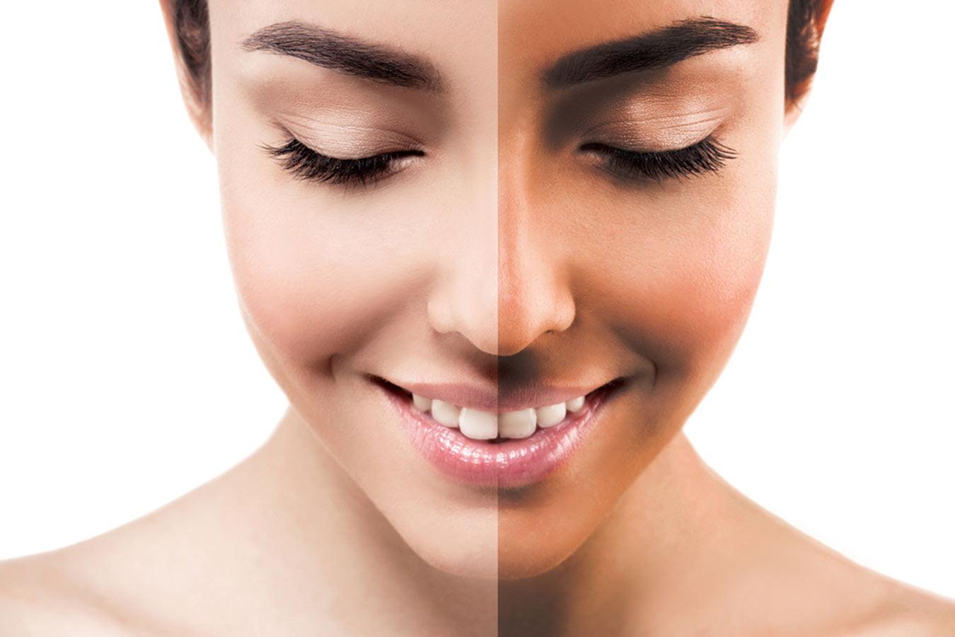 Woman's face showing before and after skin tan removal, clear and glowing complexion
