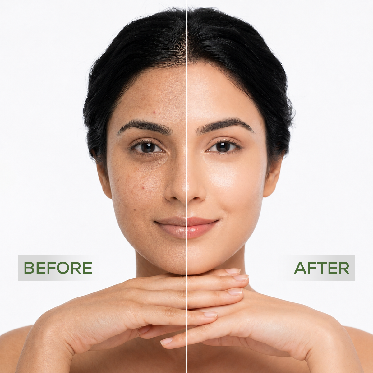 Neem Pure Anti Acne & Pimple Facewash