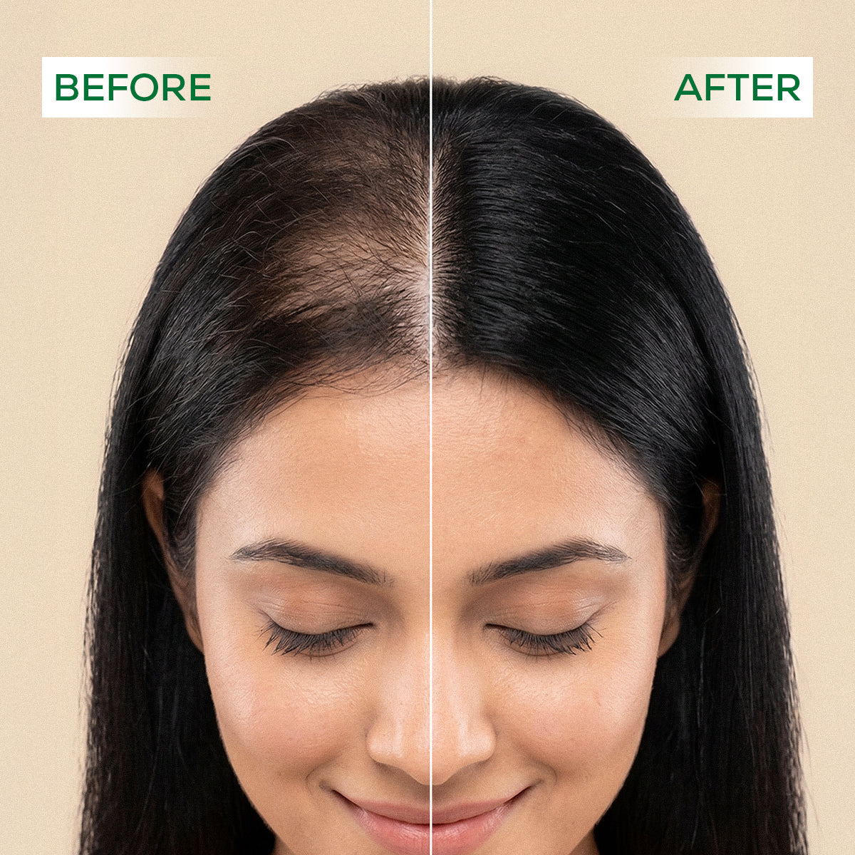 PhytoDERMA Hair Growth & Anti Hairfall Combo