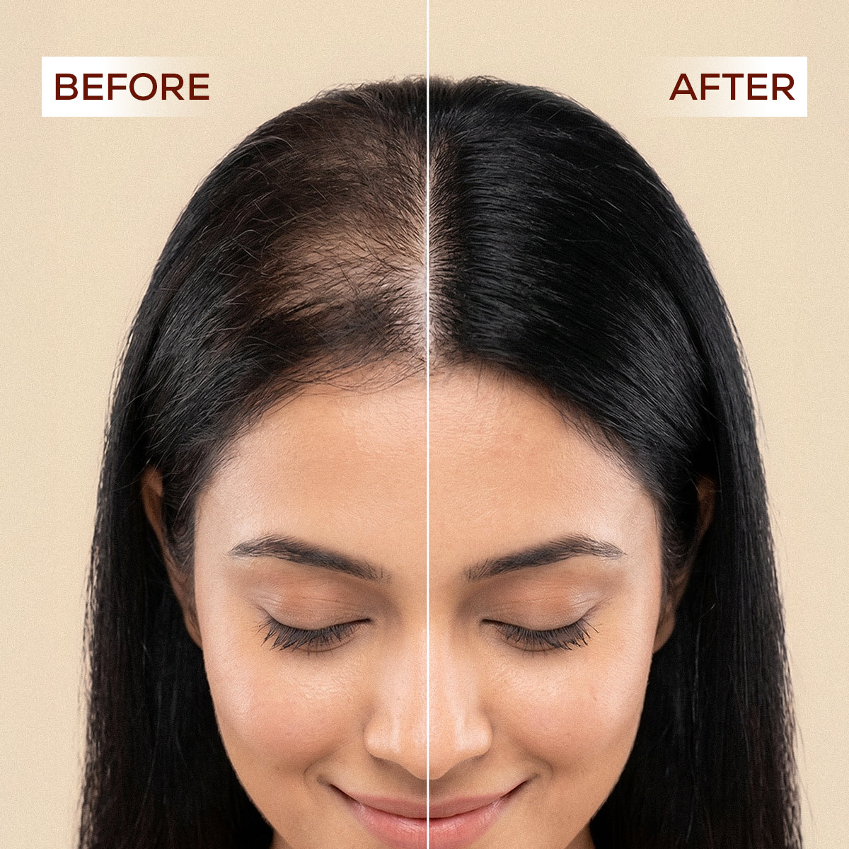 Rosemary Hair Growth Spray