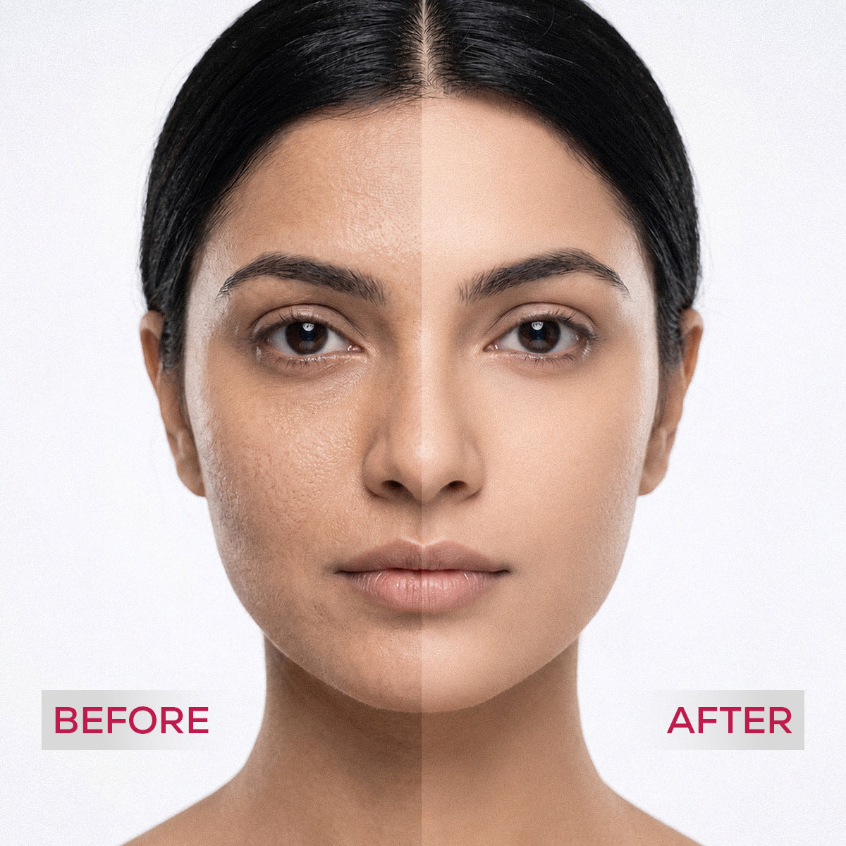 PhytoWhite Brightening & Lightening Whitening Boost Serum