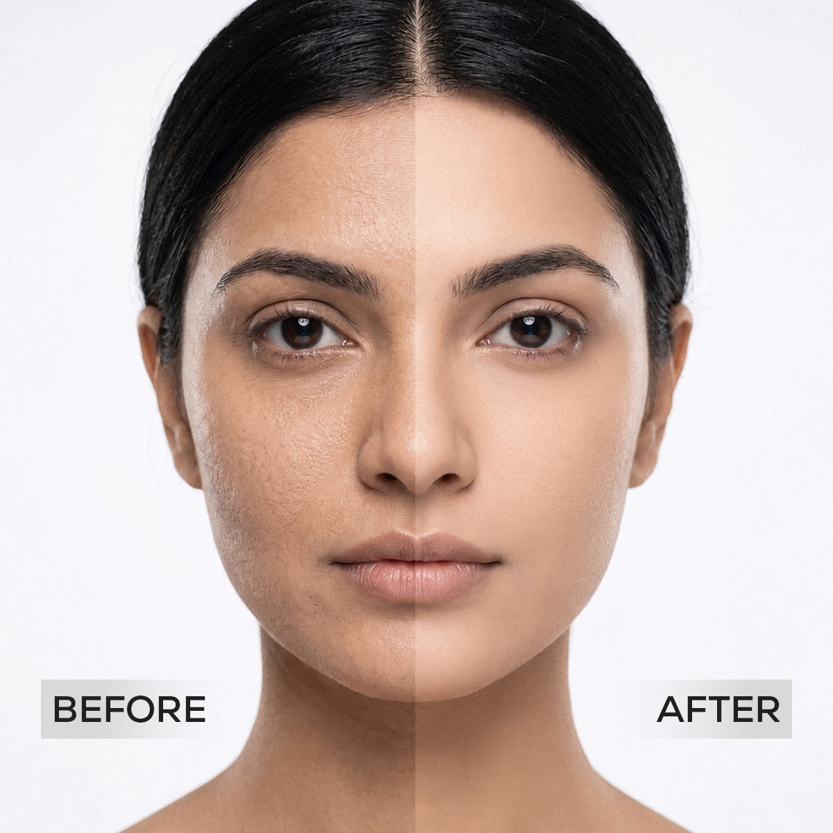 Platinum Anti-Blemish Facial Kit