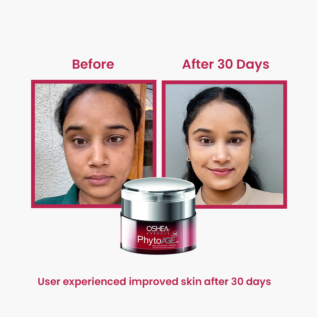 Phytoage Age Reversal Cream – Reduces Wrinkles, Firms & Restores Youthful Glow